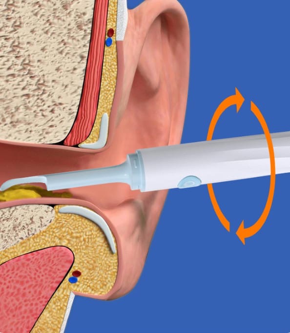 Ear wax cleaner with camera 360