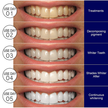 Teeth whitening strips
